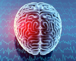 Does Brain Injury Affect Intelligence?